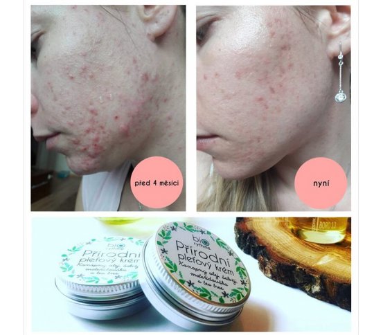 Biorythme Přírodní pleťový krém Anti Pupínek 30ml praha obchod