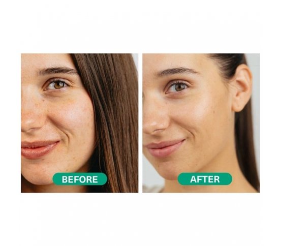 Hemptouch Pleťové sérum s kyselinou azelaovou - vzorek 1ml mini