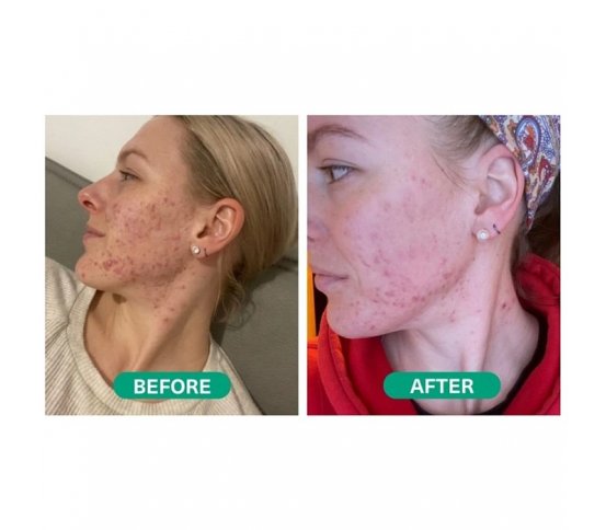 Hemptouch Vyrovnávající pleťový krém pro mastnou pleť 50ml přírodní