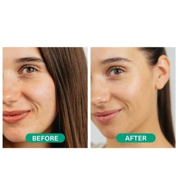 Hemptouch Pleťové sérum s kyselinou azelaovou 30ml greenstore.cz