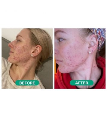 Hemptouch Vyrovnávající pleťový krém pro mastnou pleť 50ml - SLEVA